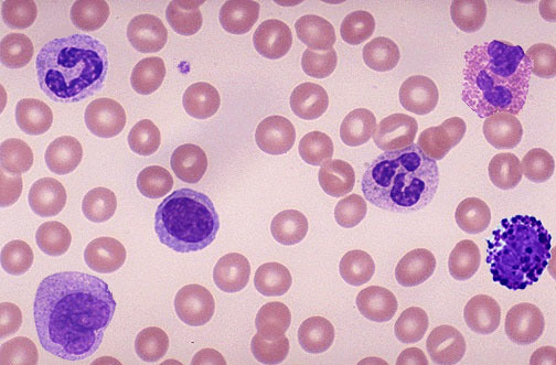显微镜下的红细胞.jpg